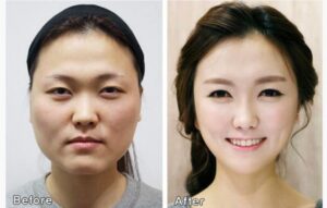 Chirurgia Corea