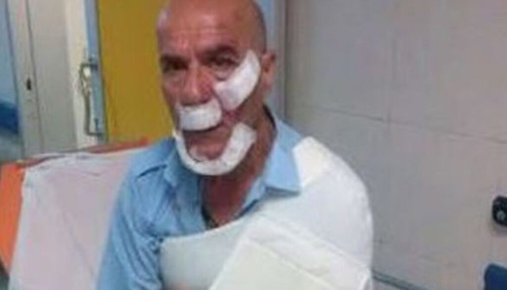 Autista aggredito a La Rustica Autista aggredito a La Rustica