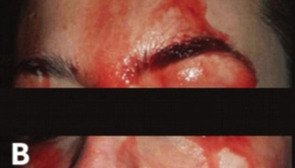 sangue.jpg