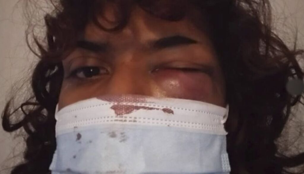 SEQUENZA-PRINCIPALE.00_37_52_22.Immagine174.jpg SEQUENZA-PRINCIPALE.00_37_52_22.Immagine174.jpg