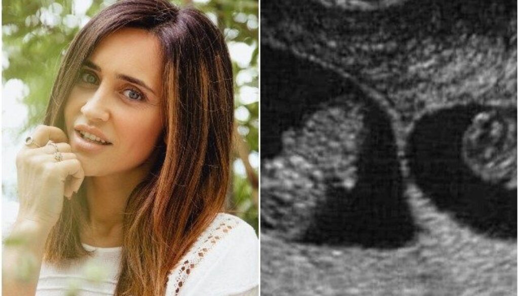 Ilenia-Lazzarin-incinta.jpg Ilenia-Lazzarin-incinta.jpg