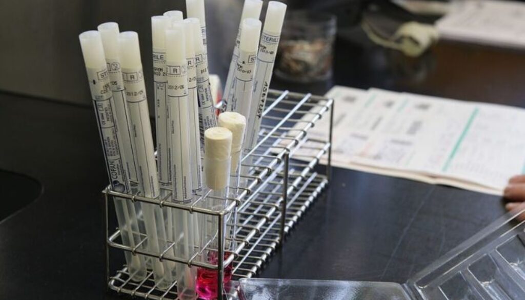 test-salivare.jpg test-salivare.jpg