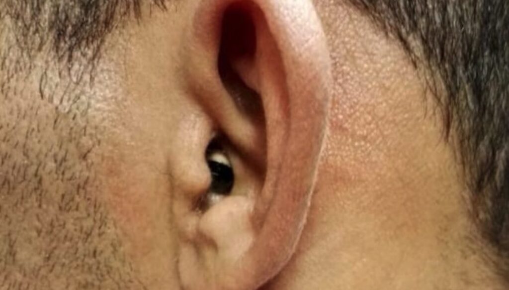 auricolare.jpg