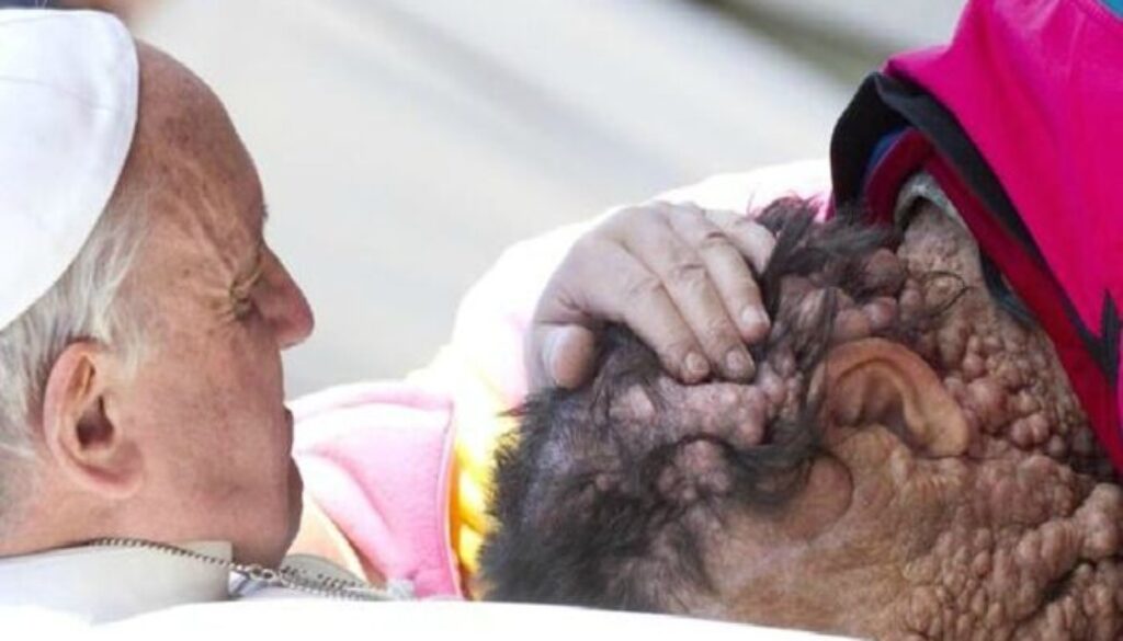 papa-uomo-sfigurato.jpg